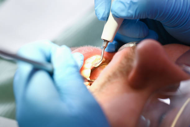 Best Emergency Tooth Extraction in Meadows Place, TX